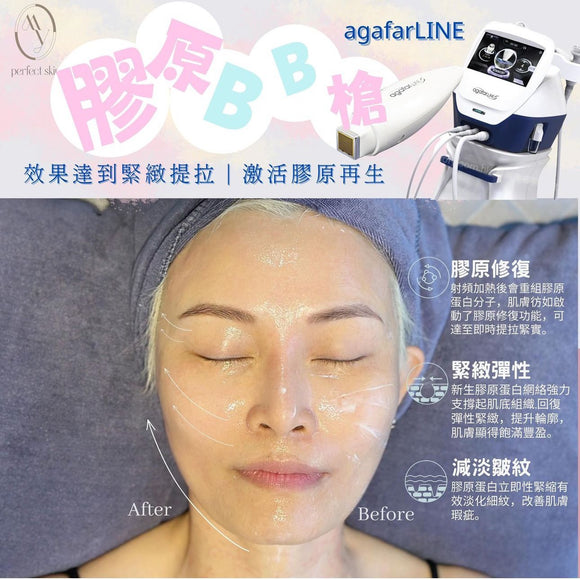 MY Perfect Skin Beauty | Agafar line 膠原再生BB槍面部療程